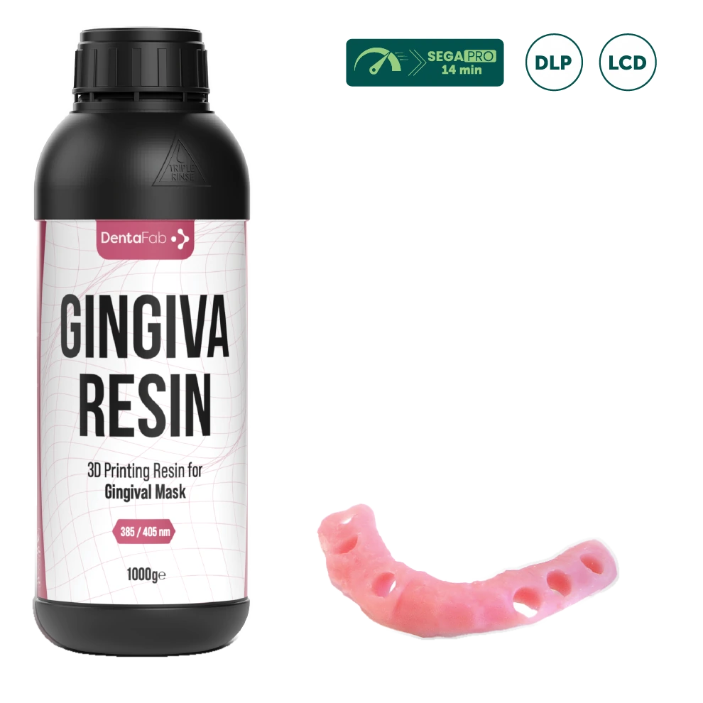Gingiva