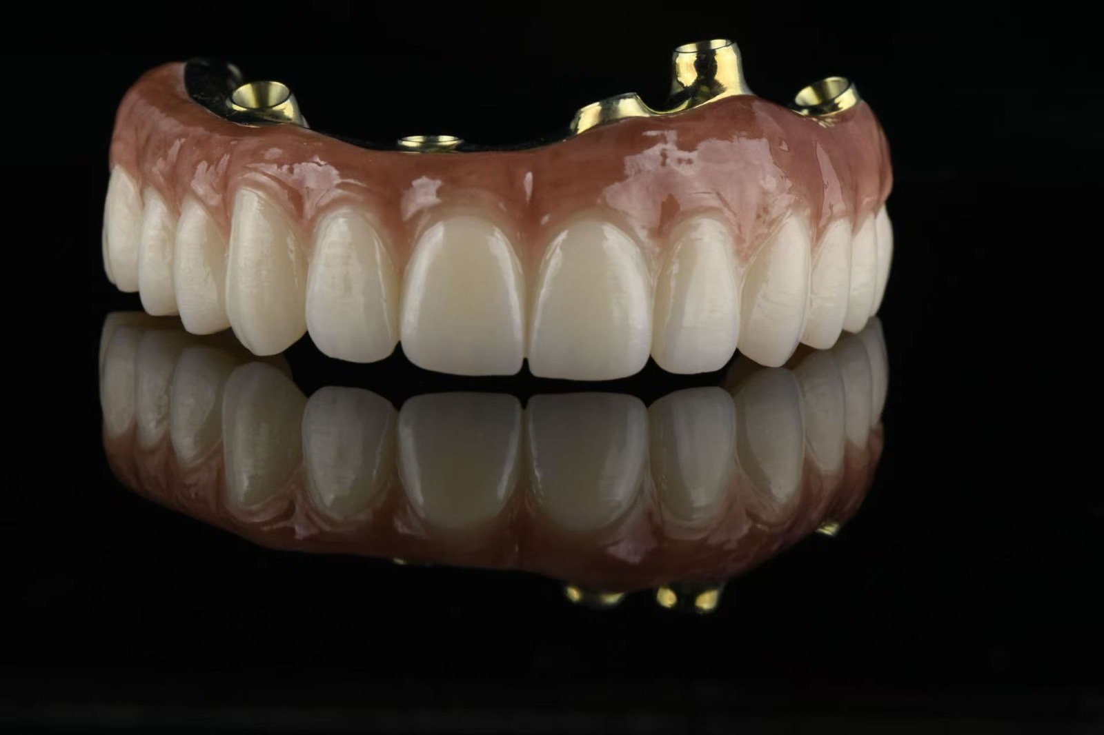 All on X full-arch restoration — front view with implant connections