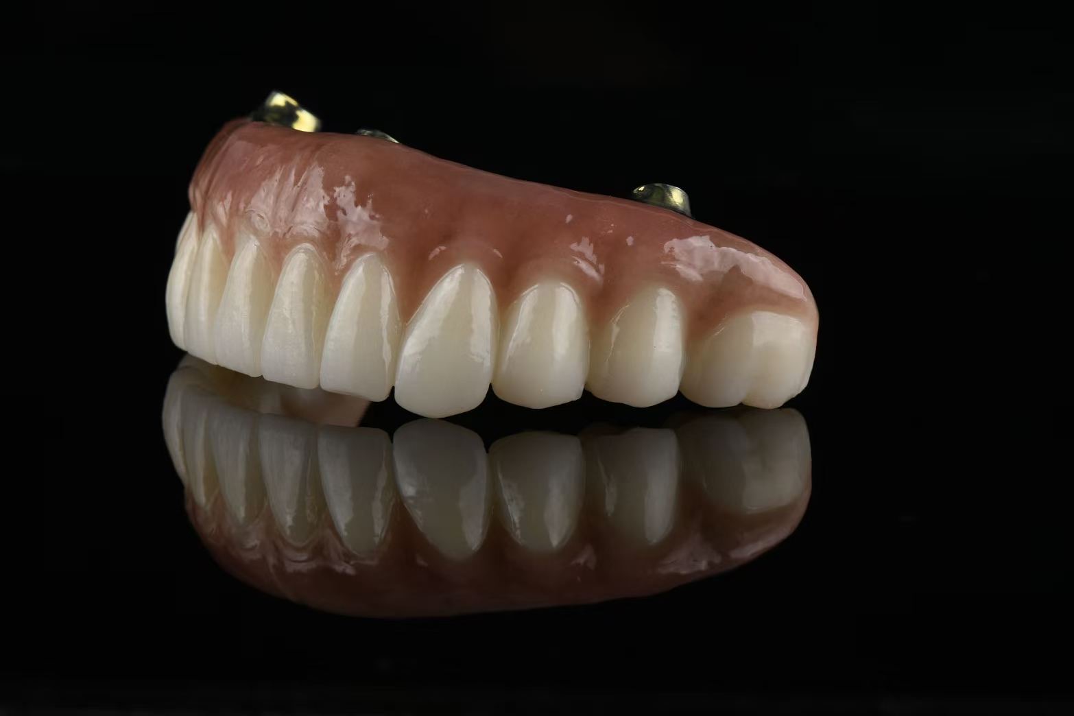 All on X full-arch restoration — angled side view