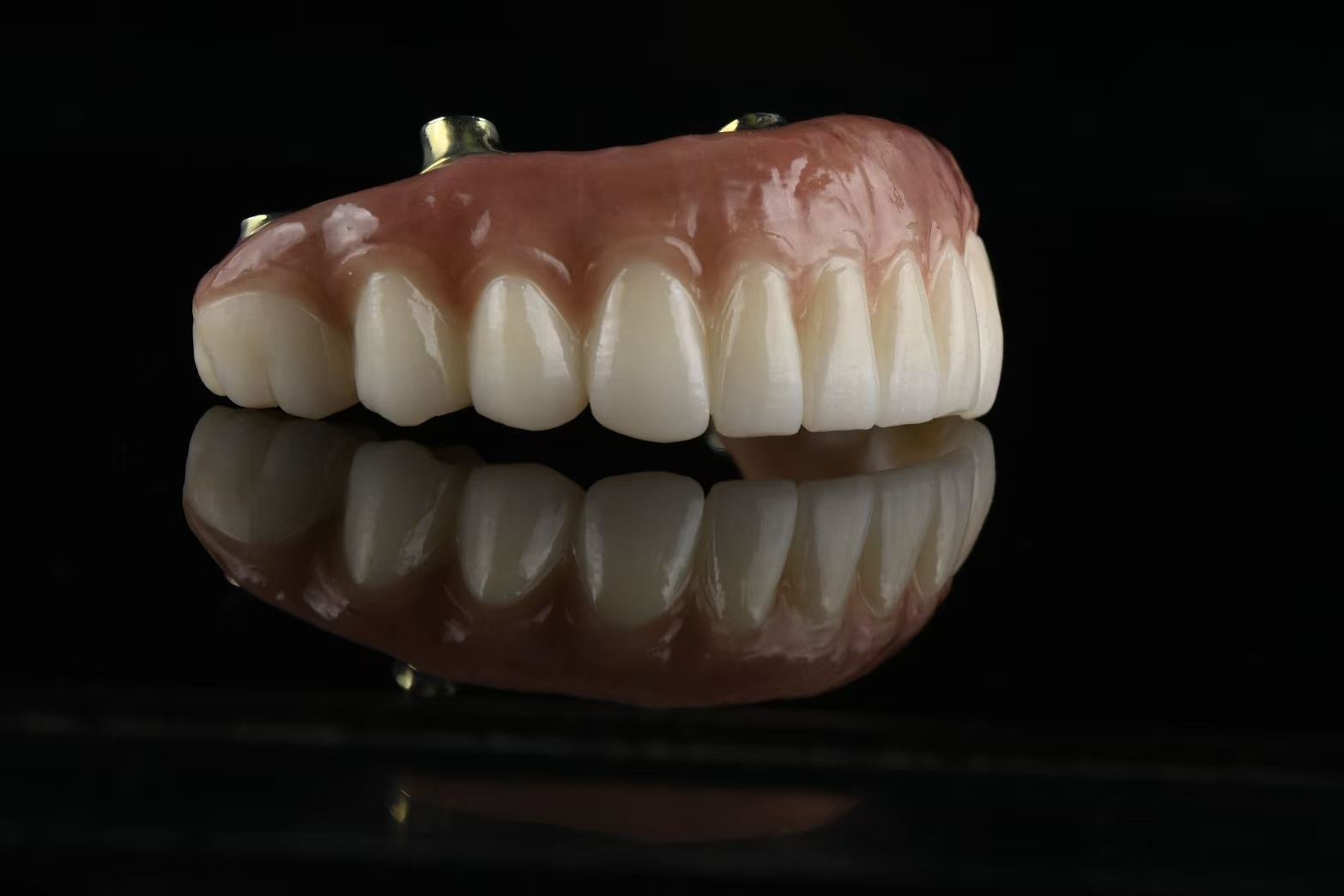 All on X full-arch restoration — opposite angled view