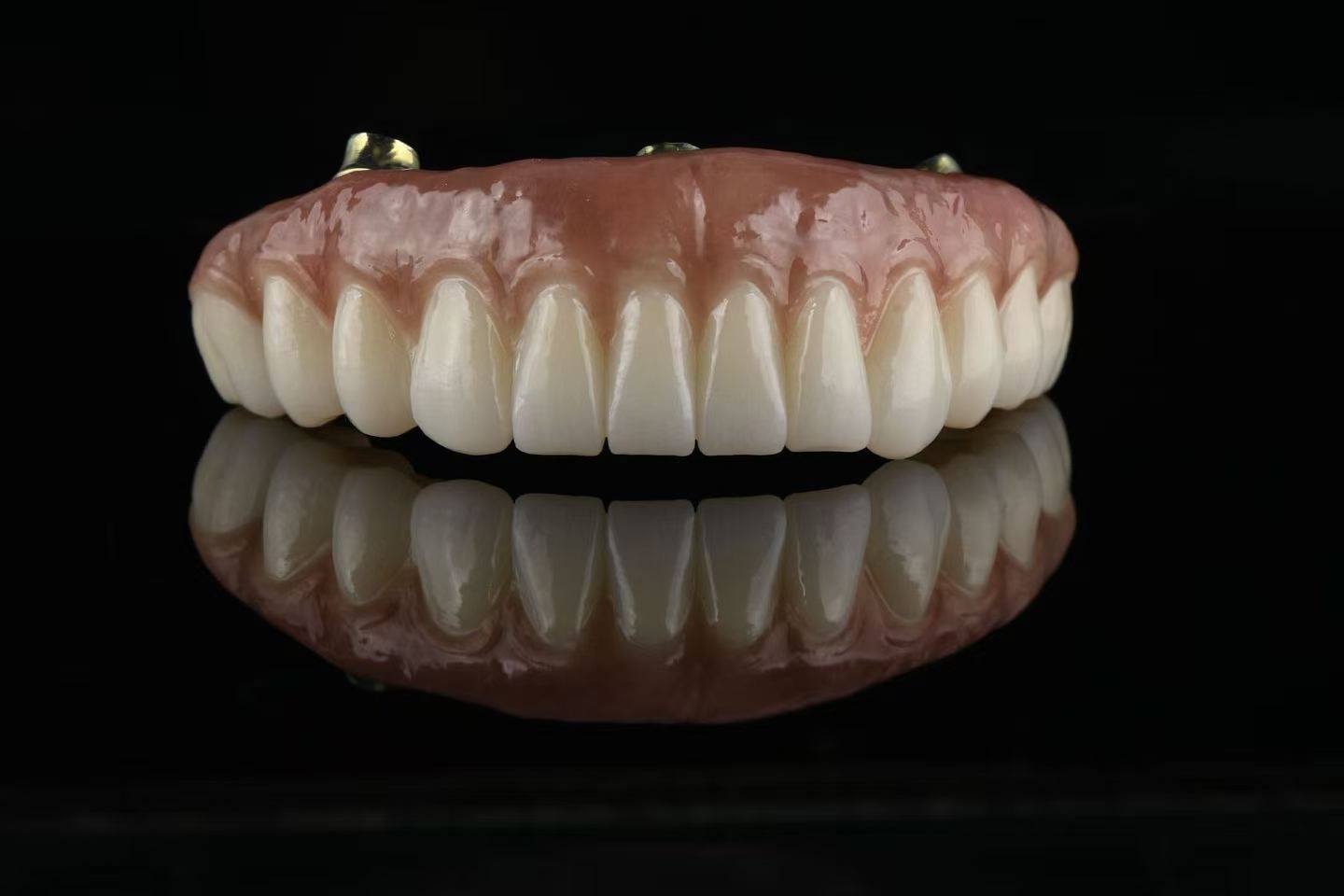 All on X full-arch restoration — straight-on front view