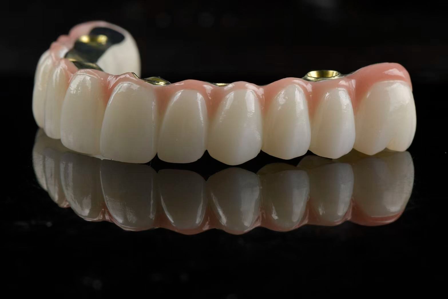 Full-arch composite restoration with gold bar