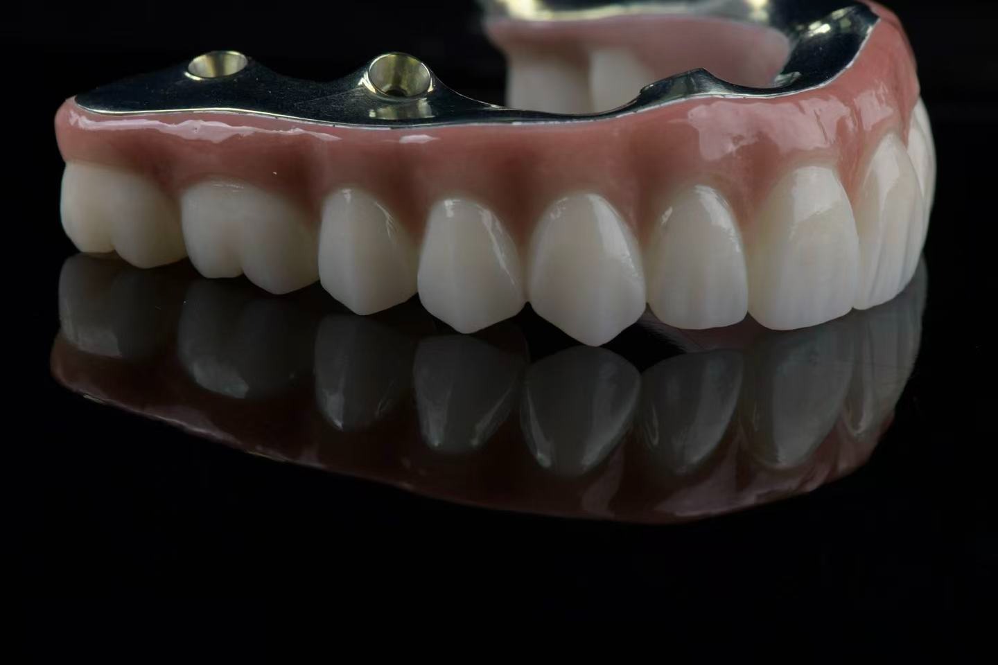 Metal framework with prosthesis — angled view