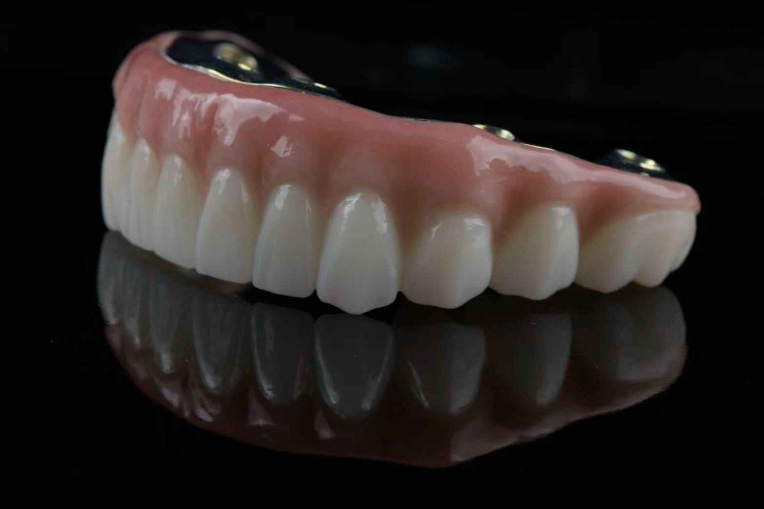 Upper arch prosthesis — angled view