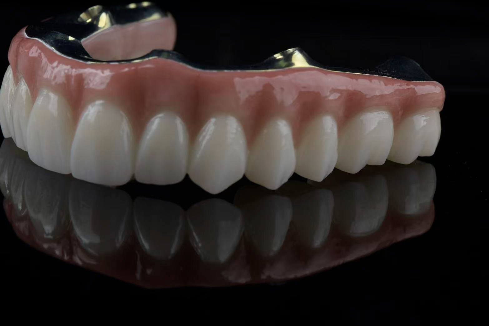 Upper arch prosthesis — side view