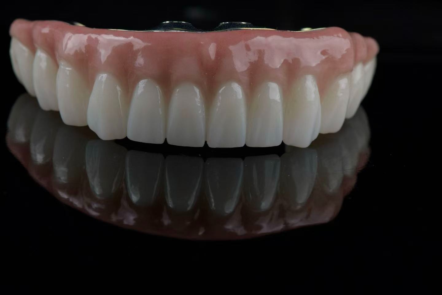 Upper arch zirconia restoration — front view