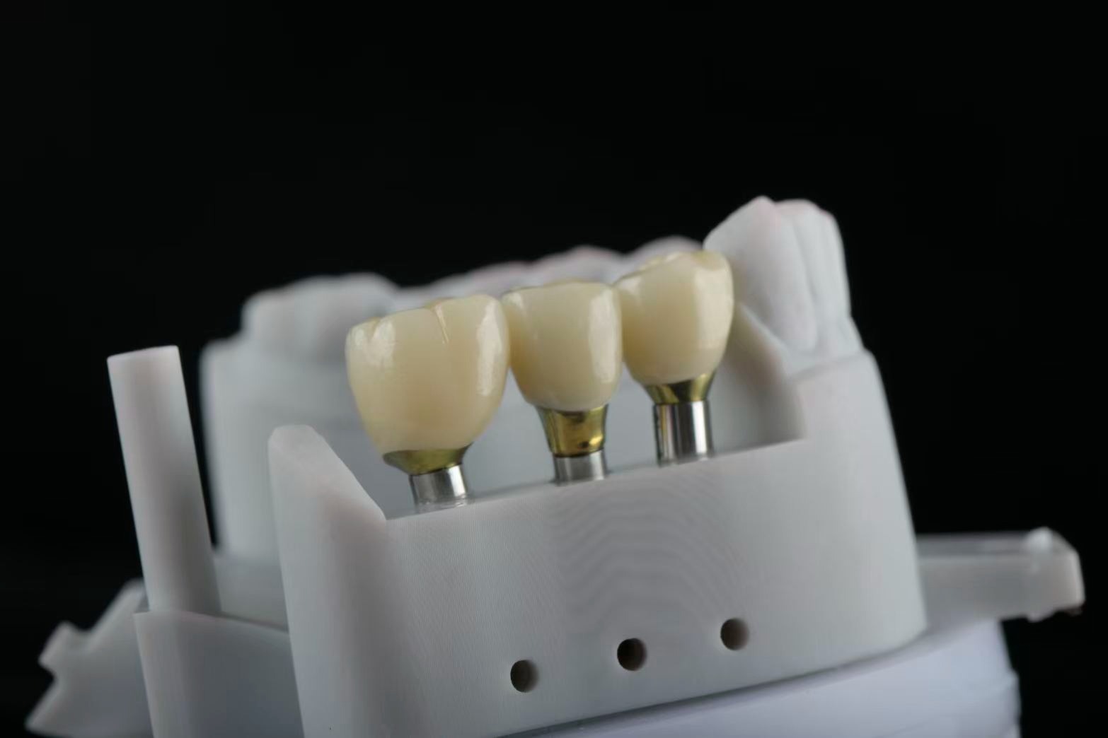 Implant-supported crowns on printed model — angled view