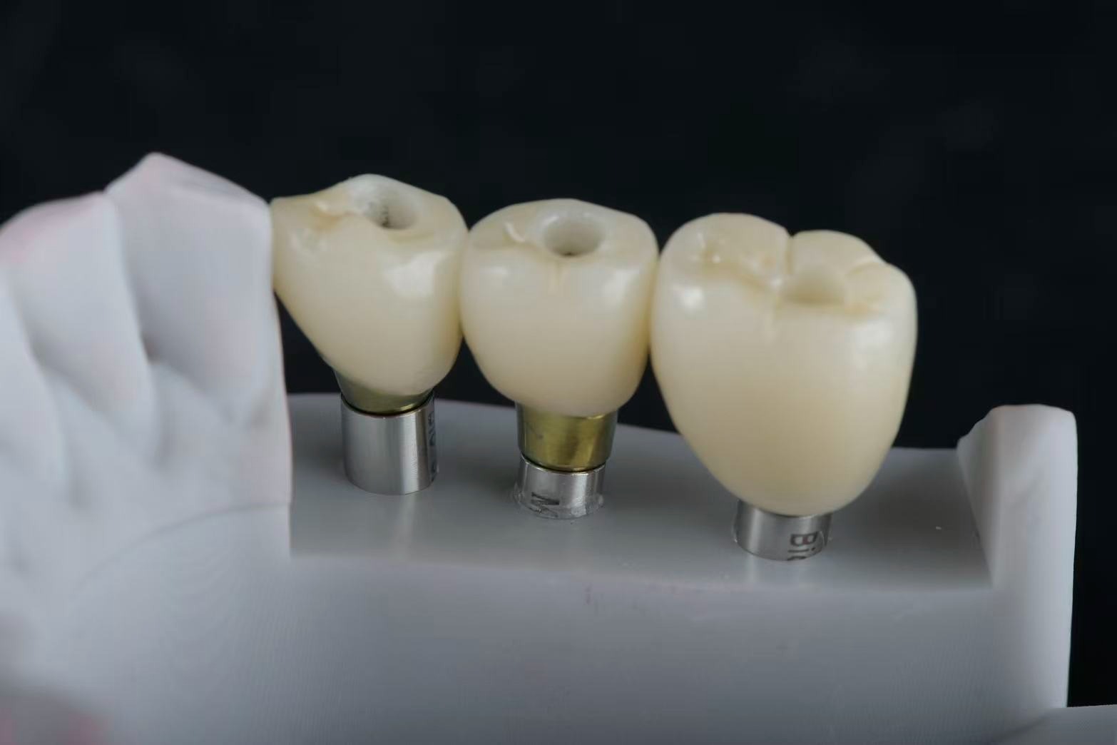 Implant crowns showing screw-access channels
