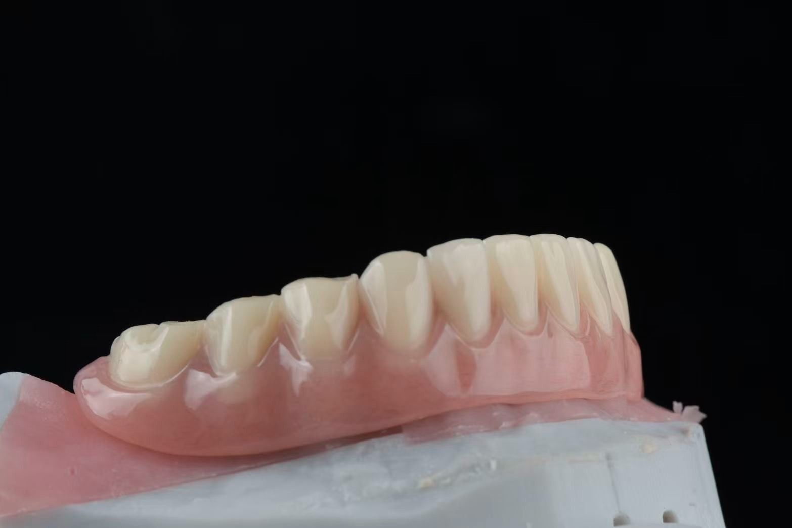 Lower overdenture — side