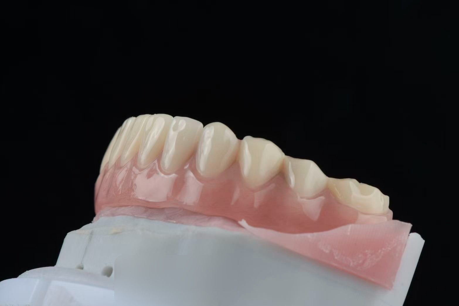 Lower overdenture — angled
