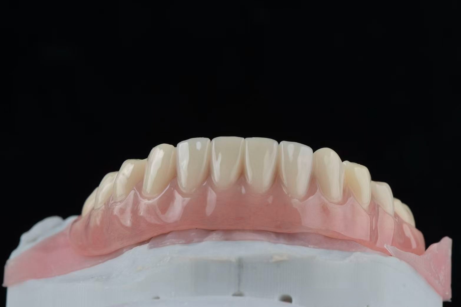 Lower overdenture — front