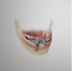 DirectIP lower arch demonstration