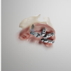 DirectIP upper arch demonstration