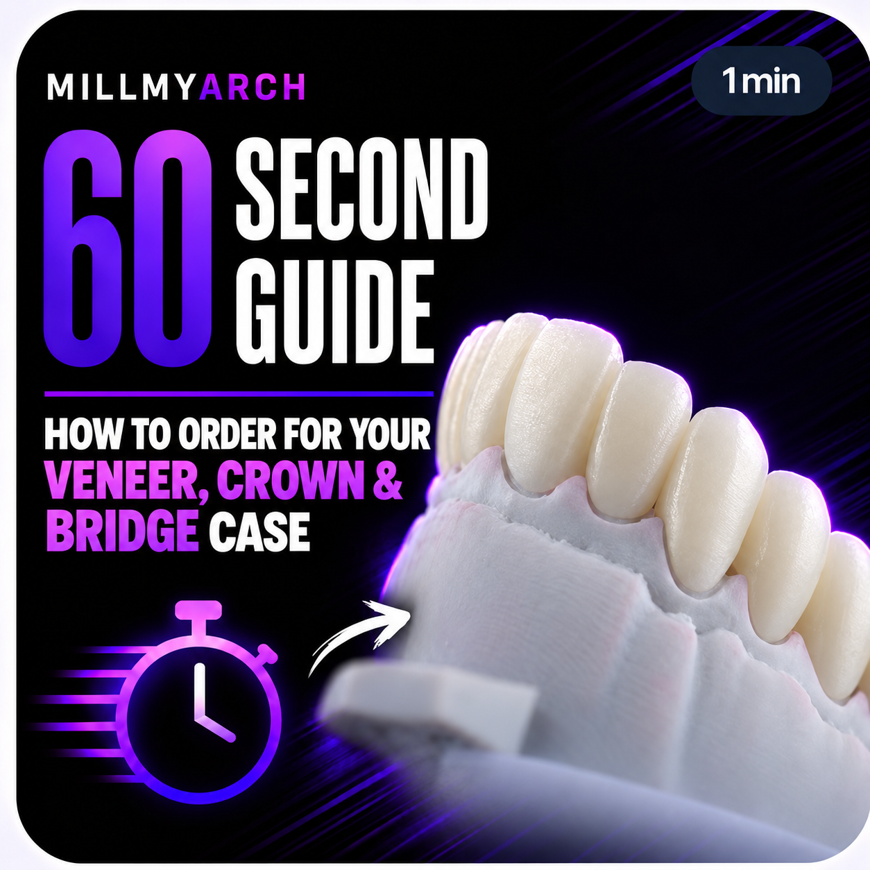 How to Order Your Veneer / Crown / Bridge Case — Submitting a veneer, crown or bridge case